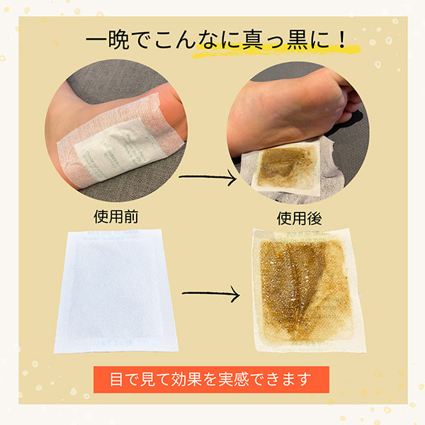 足裏樹液シート 足かるっシート 15セット(30枚)入り